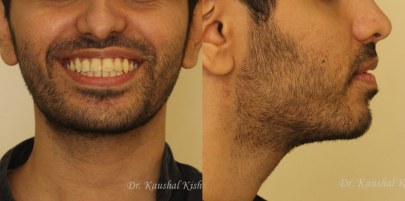 Progressive Digital Orthodontics caso Dr. Kishore Final