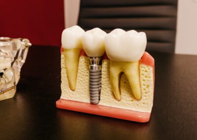 Ortodoncia pre-restauradora: clave para el éxito de las rehabilitaciones dentales