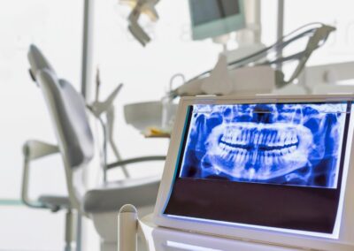 Ortodoncia vs. Implantes: Rentabilidad en la clínica dental