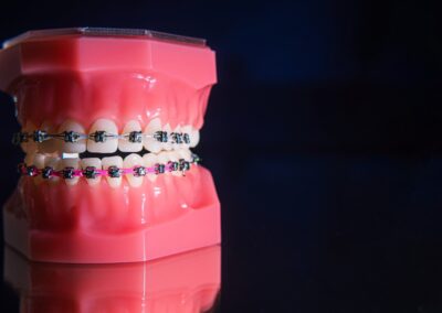  Línea media dental desviada. Un caso clínico del Dr. Cilliers